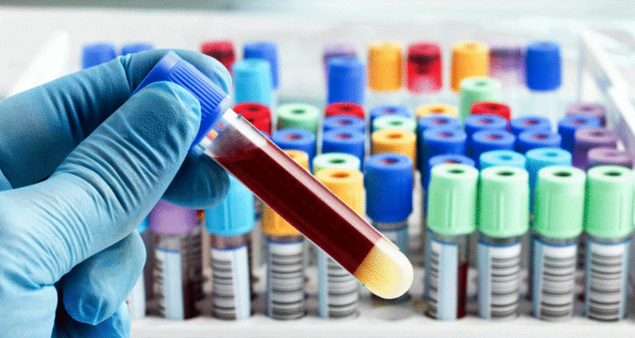 धुलिखेलमा आजदेखि कोरोना परीक्षण शुरु