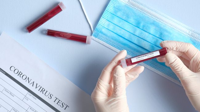 प्रदेश नम्बर १ मा  २८२ जनाको रिपोर्ट नेगेटिभ