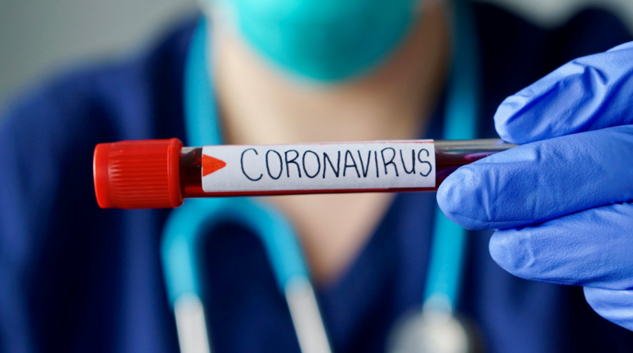कोरोना संक्रमित युवकका परिवारका ७ जनाको कोरोना टेस्ट रिपोर्ट आयो