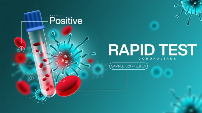 प्रदेश १ मा पनि ‘र्‍यापिड टेस्ट’ शुरु