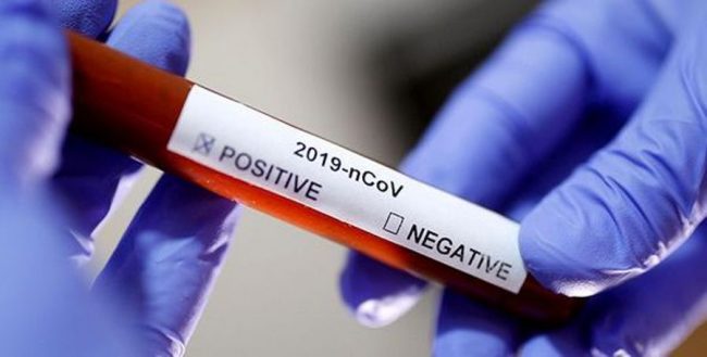 कोरोनाभाइरसको विषयमा नयाँ तथ्यको खोजी, औलो रोगसँग भेटियो यस्तो विशेष सम्बन्ध