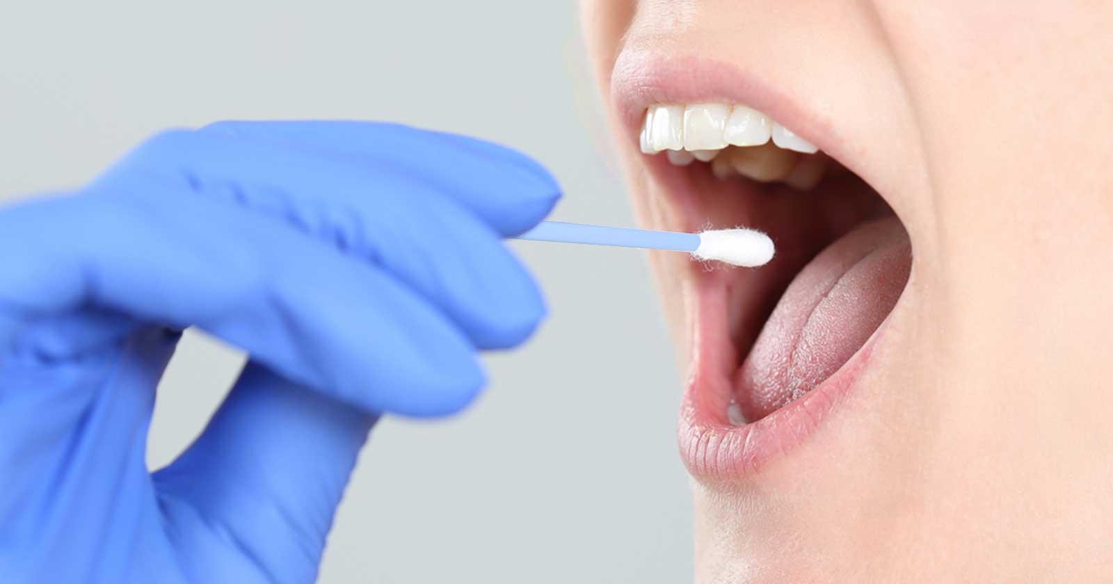 उदयपुरमा लुकेर बसेका १२ जना भारतीयको कोरोना परीक्षण तयारी