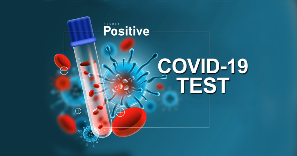 नेपालमा थप ७ जनामा कोरोना पुष्टि, संक्रमितको संख्या ८२ पुग्यो