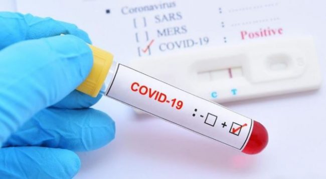 चितवनकी महिलाको चौँथो कोरोना रिपोर्ट पनि पोजेटिभ