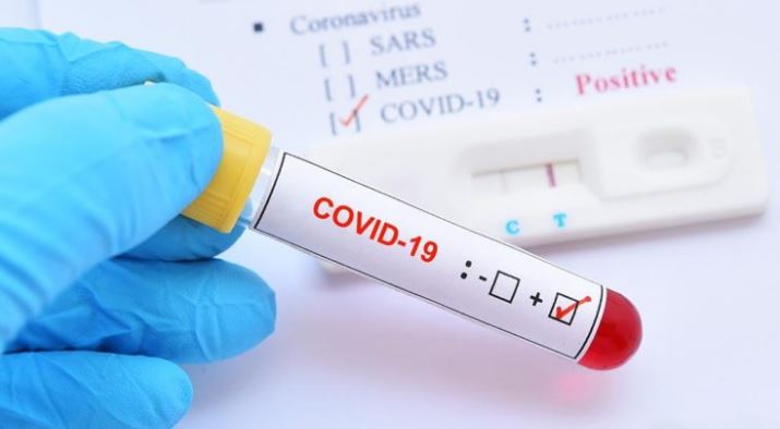 चितवनकी महिलाको चौँथो कोरोना रिपोर्ट पनि पोजेटिभ