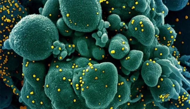 कोरोनाका कारण मृत्यु हुनेमा मेक्सिको पुग्यो चौथो स्थानमा