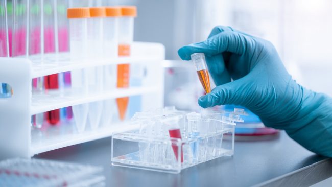 कोरोनाभाइरस टेस्ट किटमा ७ अर्ब घोटालाको आरोपमा जिम्बाब्वेका स्वास्थ्यमन्त्री पक्राउ