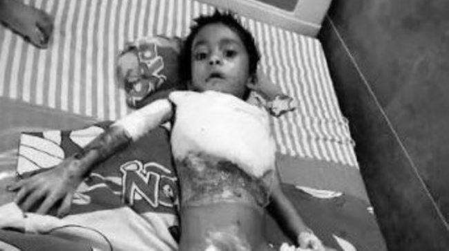 बागलुङ समाज बेल्जियमको आर्थिक सहयोगपछि कृष्णको मुम्बइमा उपचार शुरु