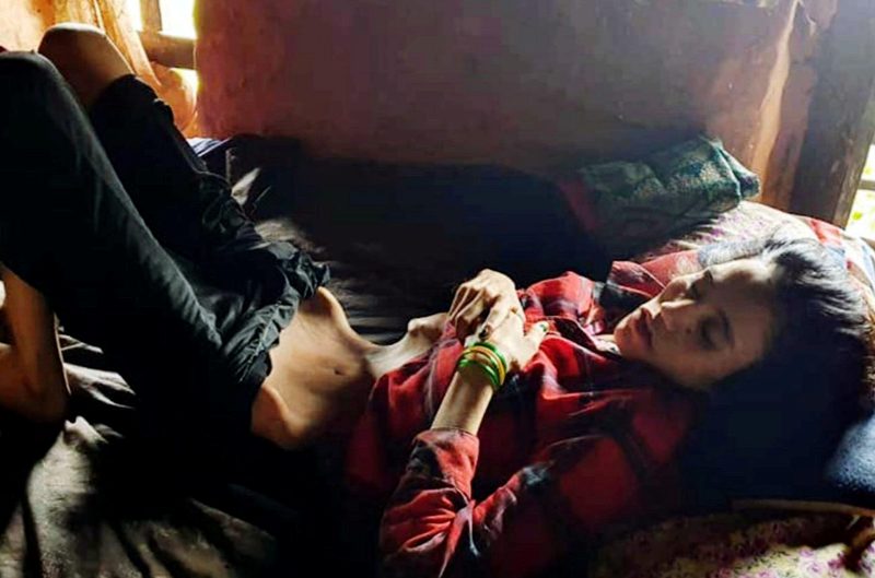 एक वर्षदेखि ओछ्यानमा थलिएकी १९ वर्षीया युवतीको उद्धार