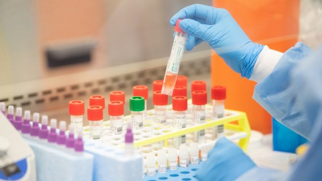 कर्णालीमा काेराेना : ५१ जना थपिए, ४५ जना काेराेना मुक्त