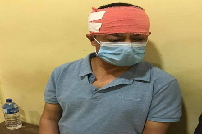 रासस वरिष्ठ समाचारदाता कार्कीमाथि सांघातिक आक्रमण