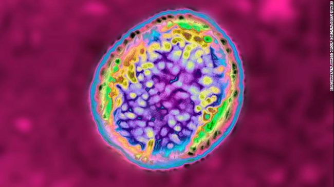 चीनमा नयाँ महामारी फैलियो, ३ हजार २ सय भन्दा धेरैमा संक्रमण पुष्टि