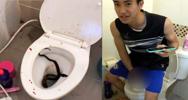 शौचालयमा बस्नासाथ १८ वर्षका किशोरको गुप्तांगमा सर्पले टोकिदियो