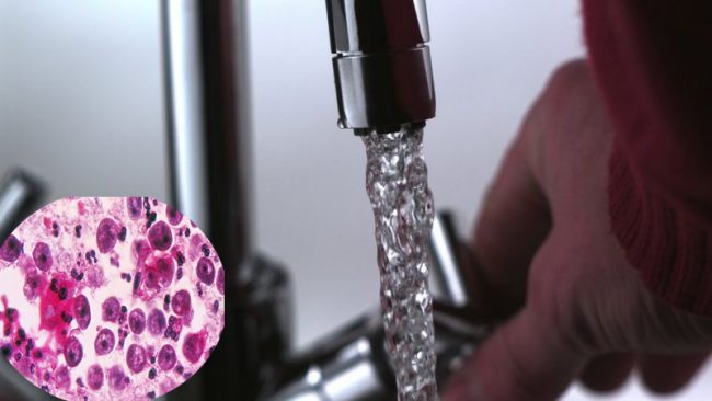 अमेरिकी शहरको पानीमा मस्तिष्क खाने सूक्ष्मजीव  भेटियो