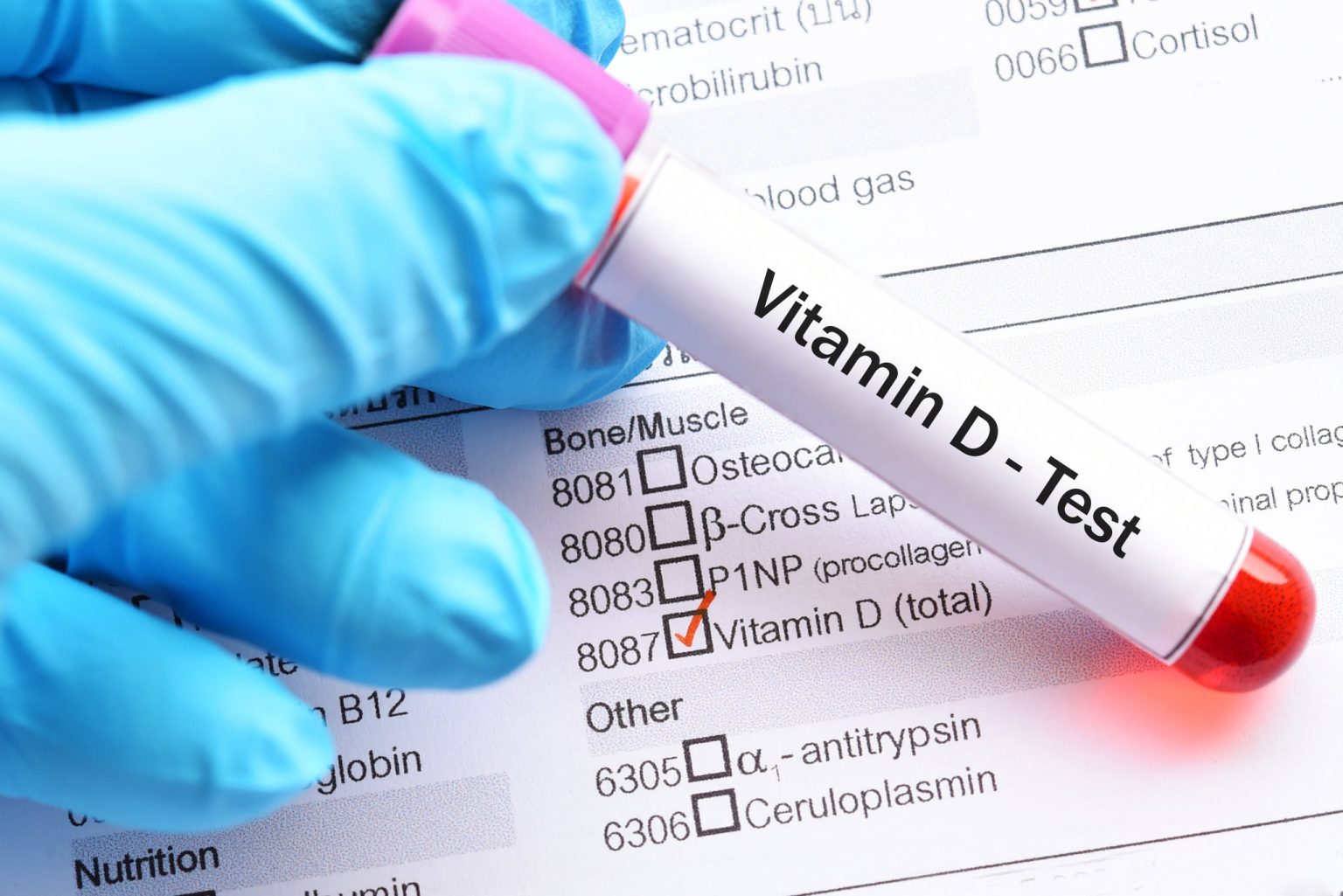 анализ крови на витамин D