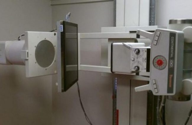 ग्रामीण भिडियो एक्सरेमा महिलाको सहभागिता