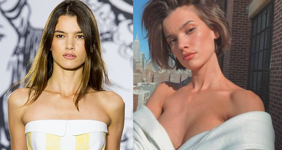 घरबाटै रहस्यमय रुपमा हराएकी मोडल १ वर्षपछि झुपडीबस्तीमा भौंतारिइरहेकी भेटिइन्