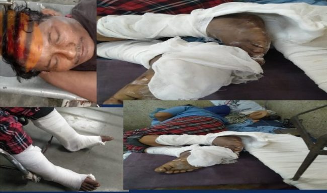 मुम्बईमा एक नेपालीको काम गर्दा गर्दै गम्भीर दुर्घटनामा दुवै खुट्टा भाँचियो, क्षति पूर्ति मिलेन