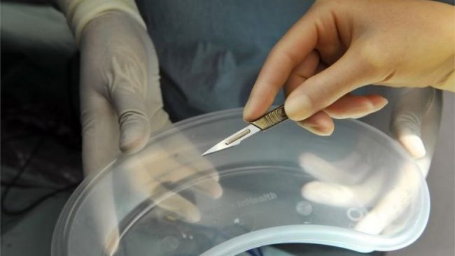 दुर्घटनामा परेका मानिसको अङ्ग चोर्ने चिकित्सकहरुलाई जेल सजाय