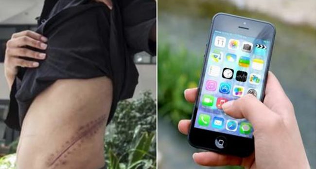 मजाक होइन साँच्चै ! आइफोन किन्नका लागि मृगौला बेचेका युवा मृत्युसँग लड्दै