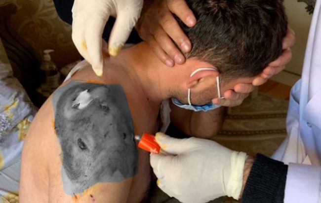 युद्ध सकियो, तर ‘घाउ अझै बाँकी नै छ’