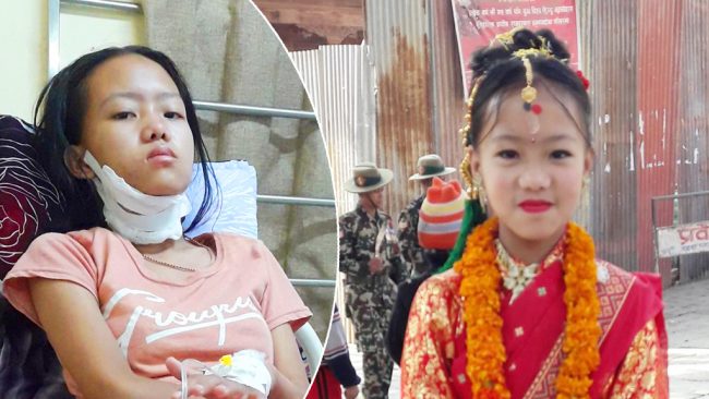 ट्याक्सी ड्राइभर कृष्ण र दीपाकी एक्ली छोरी एलिशा ब्लड क्यान्सरसँग लड्दै