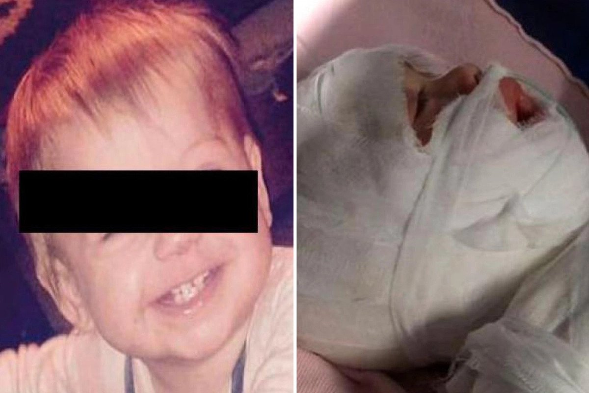 क्रुर सौतेनी आमाले श्रीमानको २ वर्षको छोरालाई जिउँदै पानीमा उमालिदिइन्