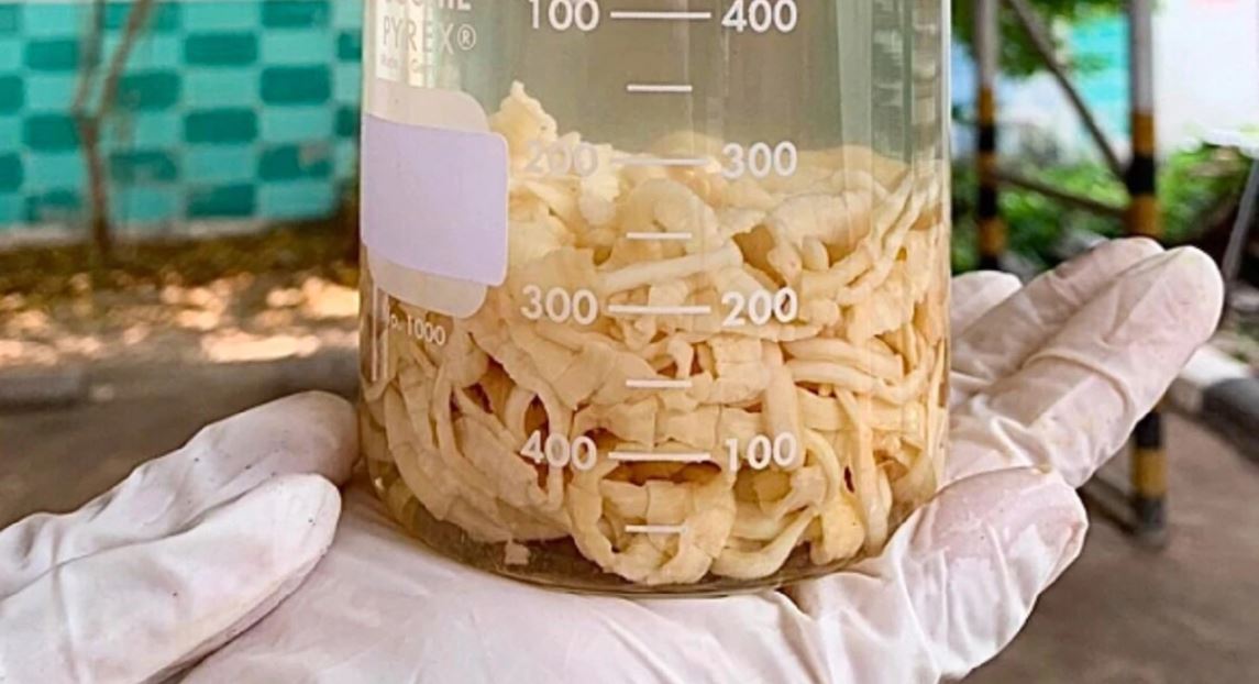 पुरुषको गुप्तांगबाट ५९ फिट लामो किरा निकालियो