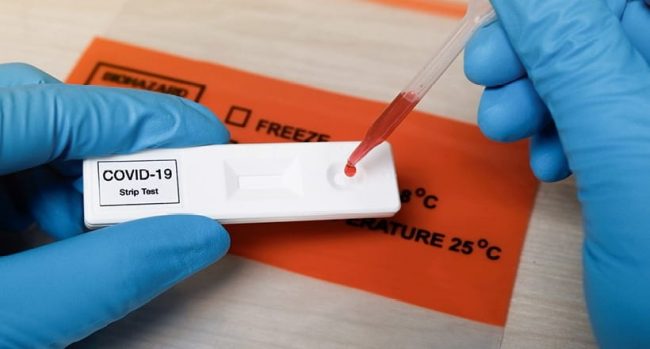 सीमानाकामा ६४ जनाको एन्टिजेन विधिबाट कोरोना परीक्षण