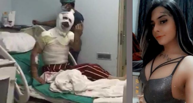 पूर्वप्रेमीले एसिडले छ्यापेपछि १८ वर्षकी किशोरीले आँखाको ज्योति गुमाइन्, गम्भीर घाइते