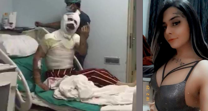 पूर्वप्रेमीले एसिडले छ्यापेपछि १८ वर्षकी किशोरीले आँखाको ज्योति गुमाइन्, गम्भीर घाइते