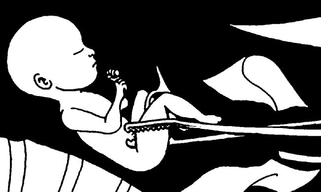 सुरक्षित गर्भपतन गराउनेको सङ्ख्या बढ्दो, तालिमकेन्द्र छैन