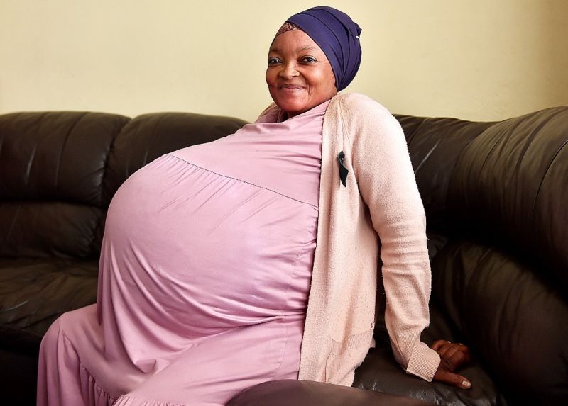 दक्षिण अफ्रिकी महिलाले १० सन्तान जन्माएको खबर असत्य