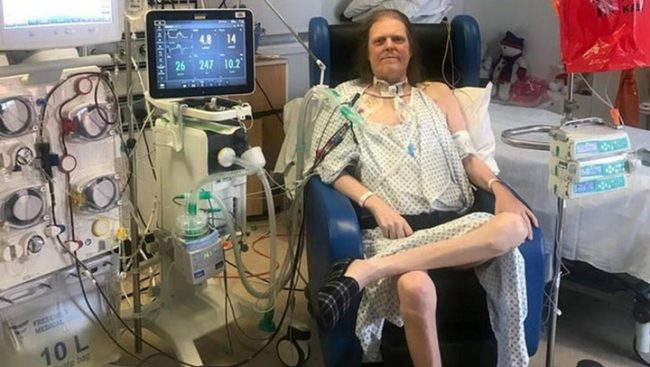 १४ महिनासम्म  अस्पताल बसेका कोरोना बिरामी ‘अब यसरी बाँचिरहन सक्दिन’ भनेर मरे