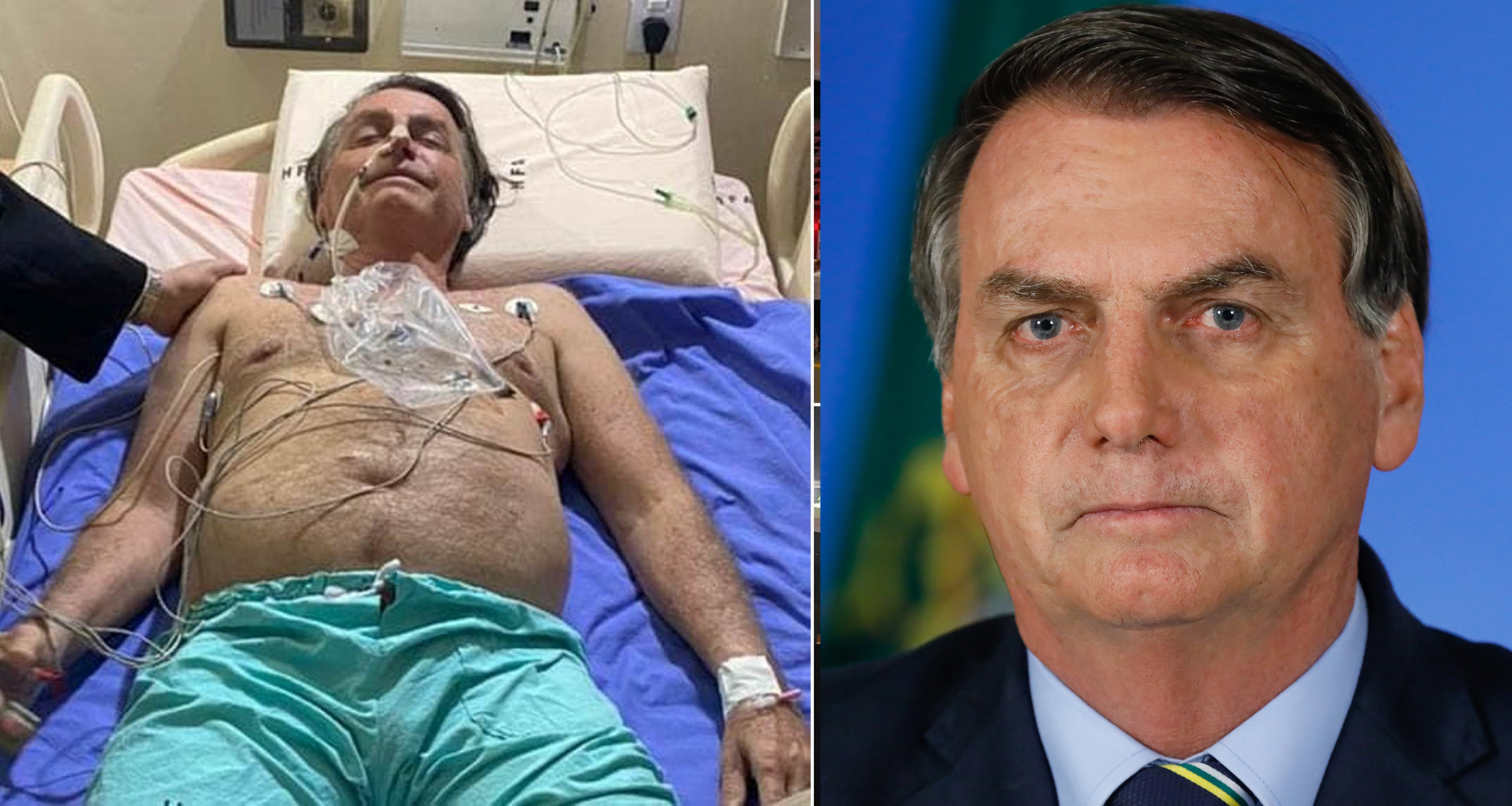 १० दिनदेखि लगातार बाडुकी लागिरहेपछि ब्राजिलका राष्ट्रपति अस्पताल भर्ना