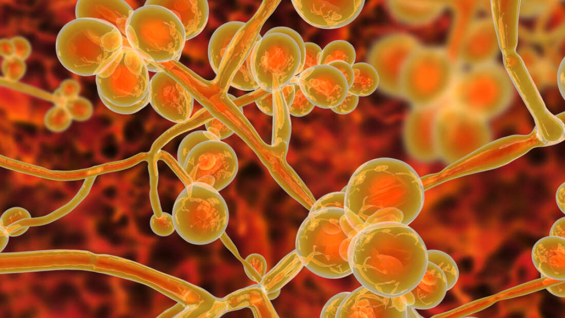 अमेरिकाका २ सहरका अस्पतालमा कुनै औषधिले काम नगर्ने सुपरबग फंगस संक्रमण फैलियो