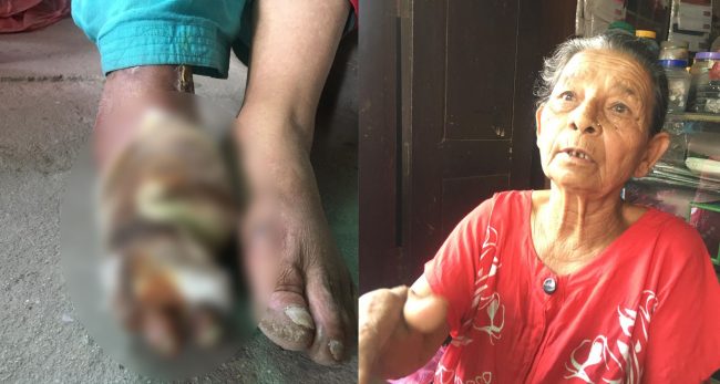 कोरोनाका कारण ६३ वर्षीया वृद्धा सडकमा रात बिताउँदै