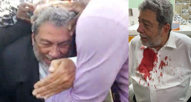 फ्रन्टलाइनरलाई खोप अनिवार्य गराउन खोज्दा ढुंगाले हानेर प्रधानमन्त्रीको टाउको फुटाइयो