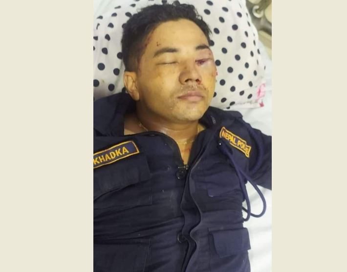 आरोपीलाई पक्राउ गर्न खोज्दा झडप, ५ प्रहरी घाइते