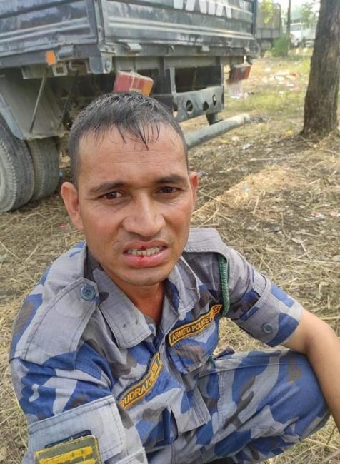 मोतिपुर घटनामा एसपी सहित  ४९ जना सुरक्षाकर्मी घाइते (अपडेट)