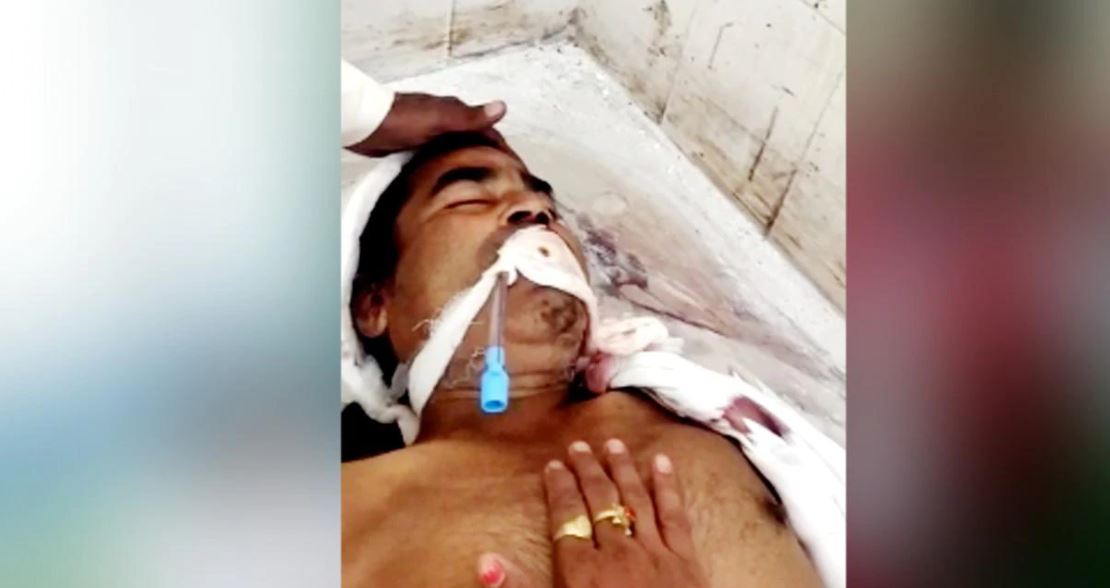 एकपछि अर्को गर्दै ३ वटा अस्पतालले मरेको भनेपछि पोस्टमार्टम गर्न लाग्दा बिरामी जिउँदै