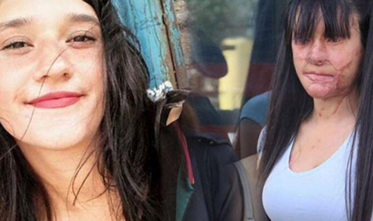 युवतीले आफूलाई एसिड हान्ने युवकलाई माफ गरिदिइन् अनि उसैसँग बिहे गरिन्