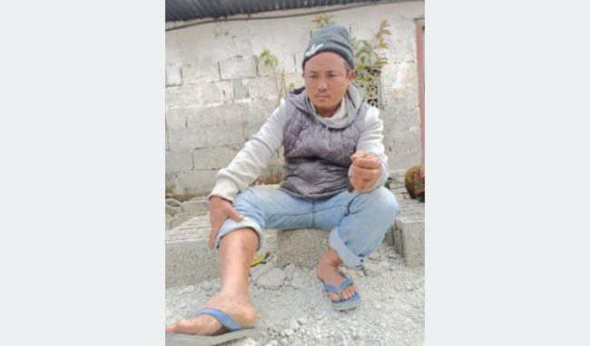 “टाउकैमाथि जहाज खस्यो, भाग्यले बाँचे”