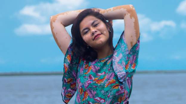 के माछा खाएपछि दूध पिउन हुन्छ ? डाक्टरहरू के भन्छन् ?