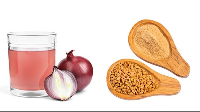 प्याज र मेथीको तेलले हटाउँछ कपालको यी समस्या