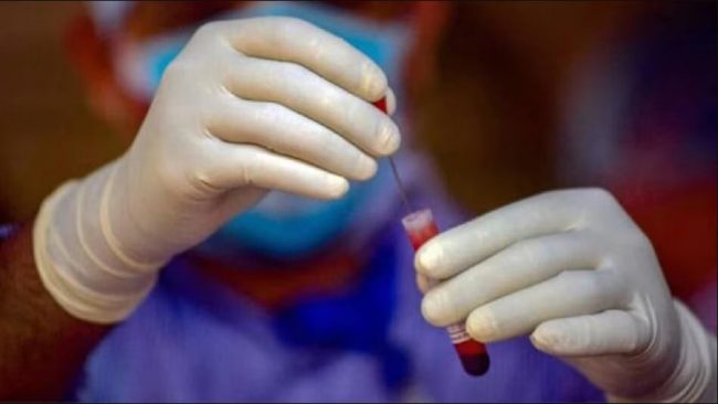 नाकबाट रगत र ज्वरो आएपछि केही घण्टामै मृत्यु… अज्ञात रोगका कारण यस देशमा २०० जना क्वारेन्टाइन