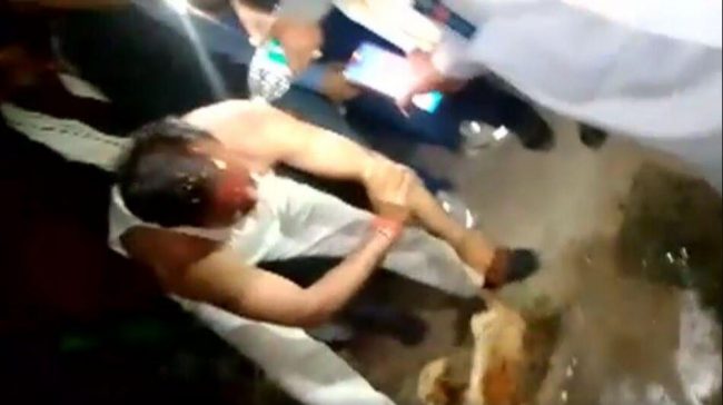 कार्यक्रममा गएका मन्त्रीको शरीरमा चिलाउने काउसो लगाइयो, कार्यक्रम छोडेर नुहाउन दौडे