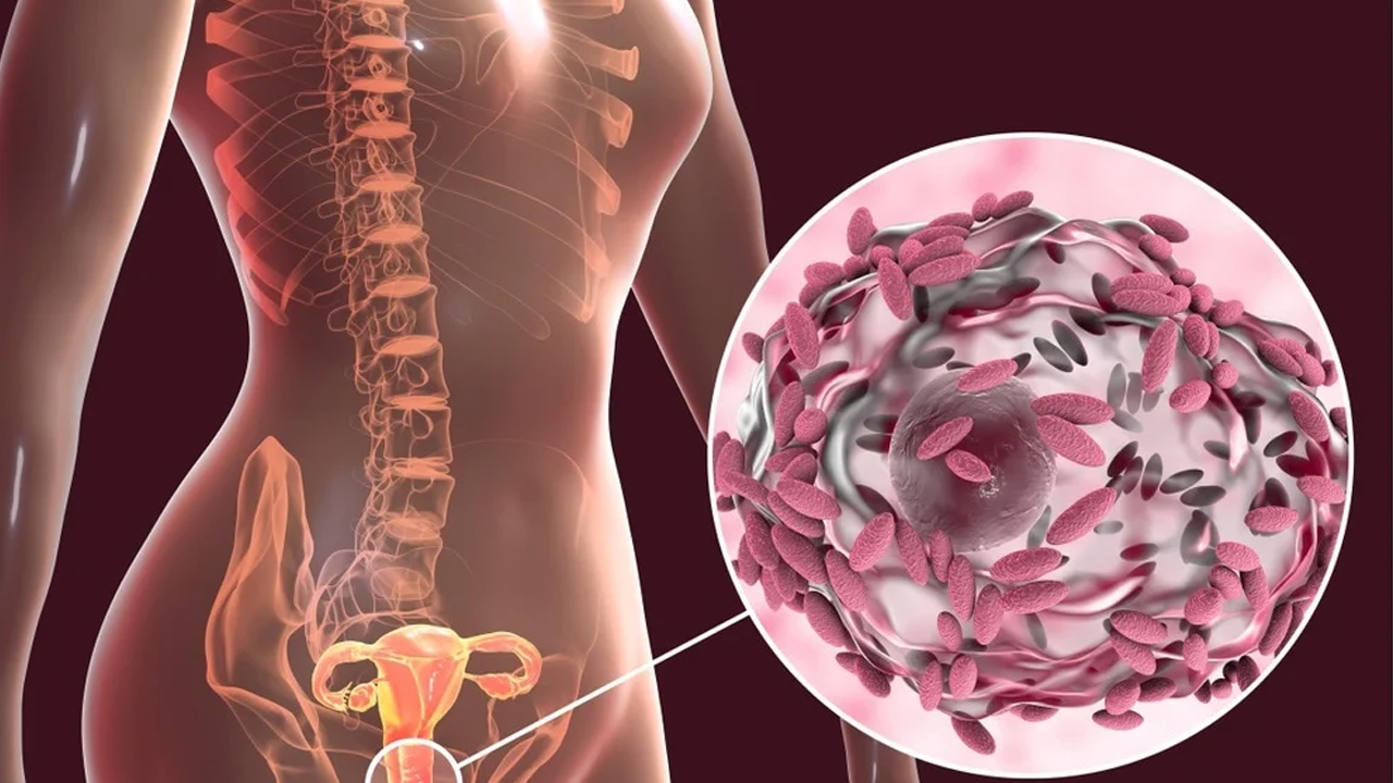 महिलालाई ब्याक्टेरियल भ्यागिनोसिस भएको पहिचान कसरी गर्ने ?