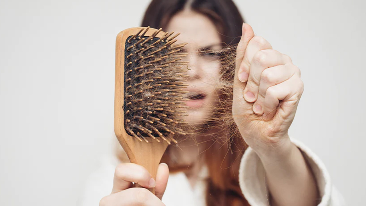 यी पाँच चिज खाँदा कपाल झर्ने समस्या बढ्छ: यसको सेवन कम गर्नुहोस्