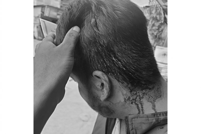बैंकका कर्मचारीमाथि आक्रमण गर्नेलाई कारबाहीको माग